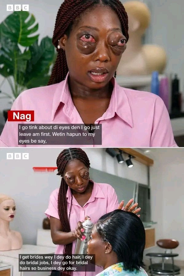 Iheanacho Deborah tweet media