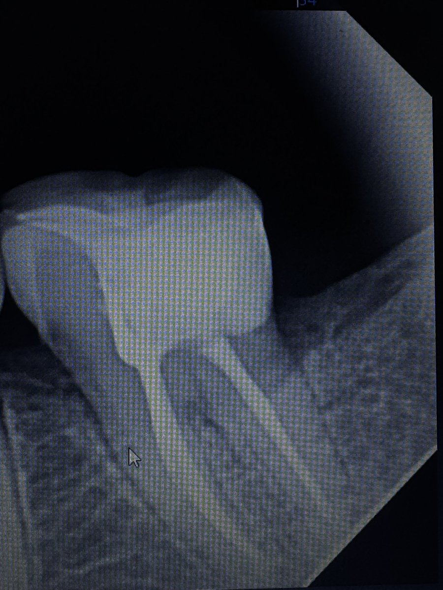 qué perra mi elevación de margen 💋