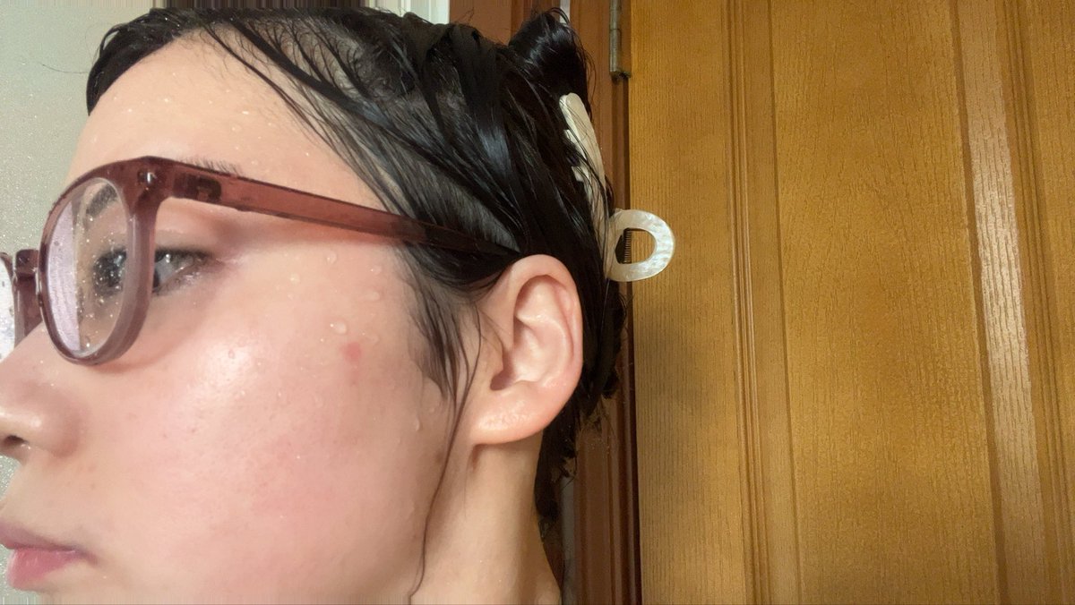 痛みで朝起きたら思いっきりほっぺの皮剥けてるんだけど何で？引っ掻いた？跡になる？😭😭😭いたーい