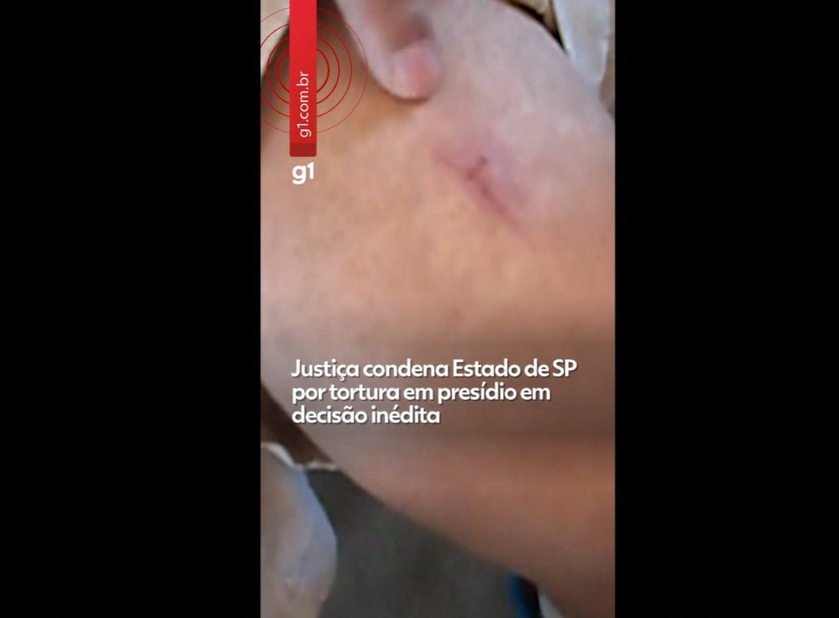 Leandro1Apc's tweet photo. Justiça condena Estado de SP por tortura em presidio de Pres. Prudente em decisão inédita; e multa de R$258 mil
https://t.co/rGWegiRk89 https://t.co/Jqha5pCnPI