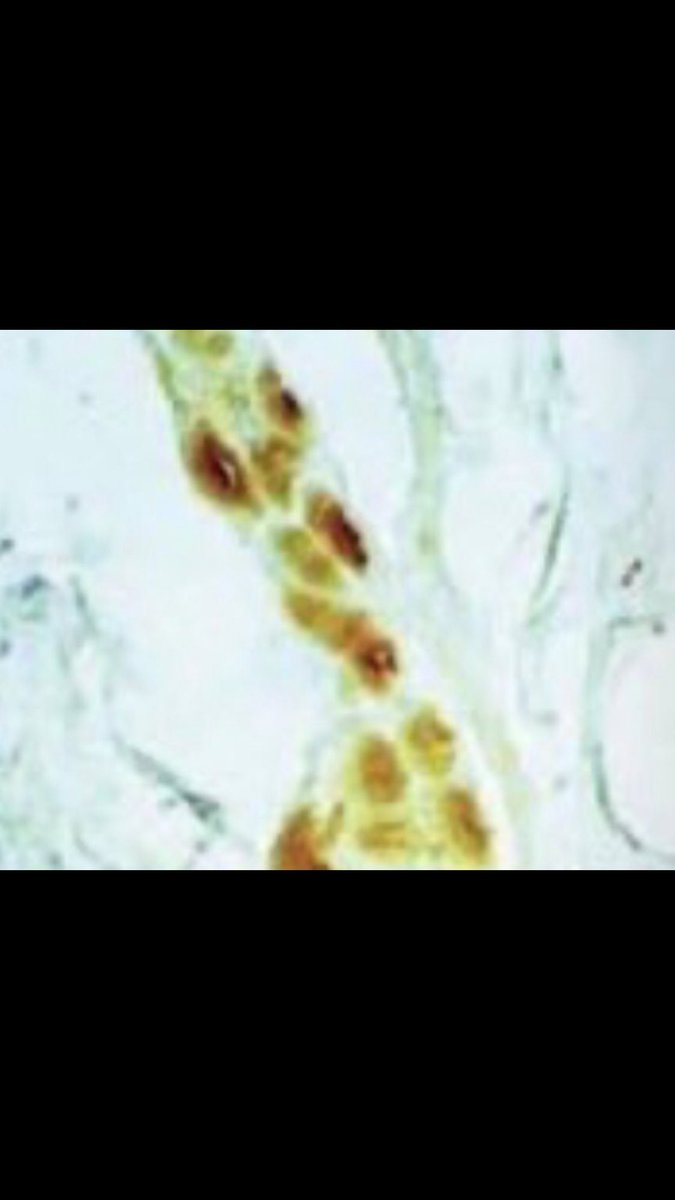 Derpas Jenkens tweet media