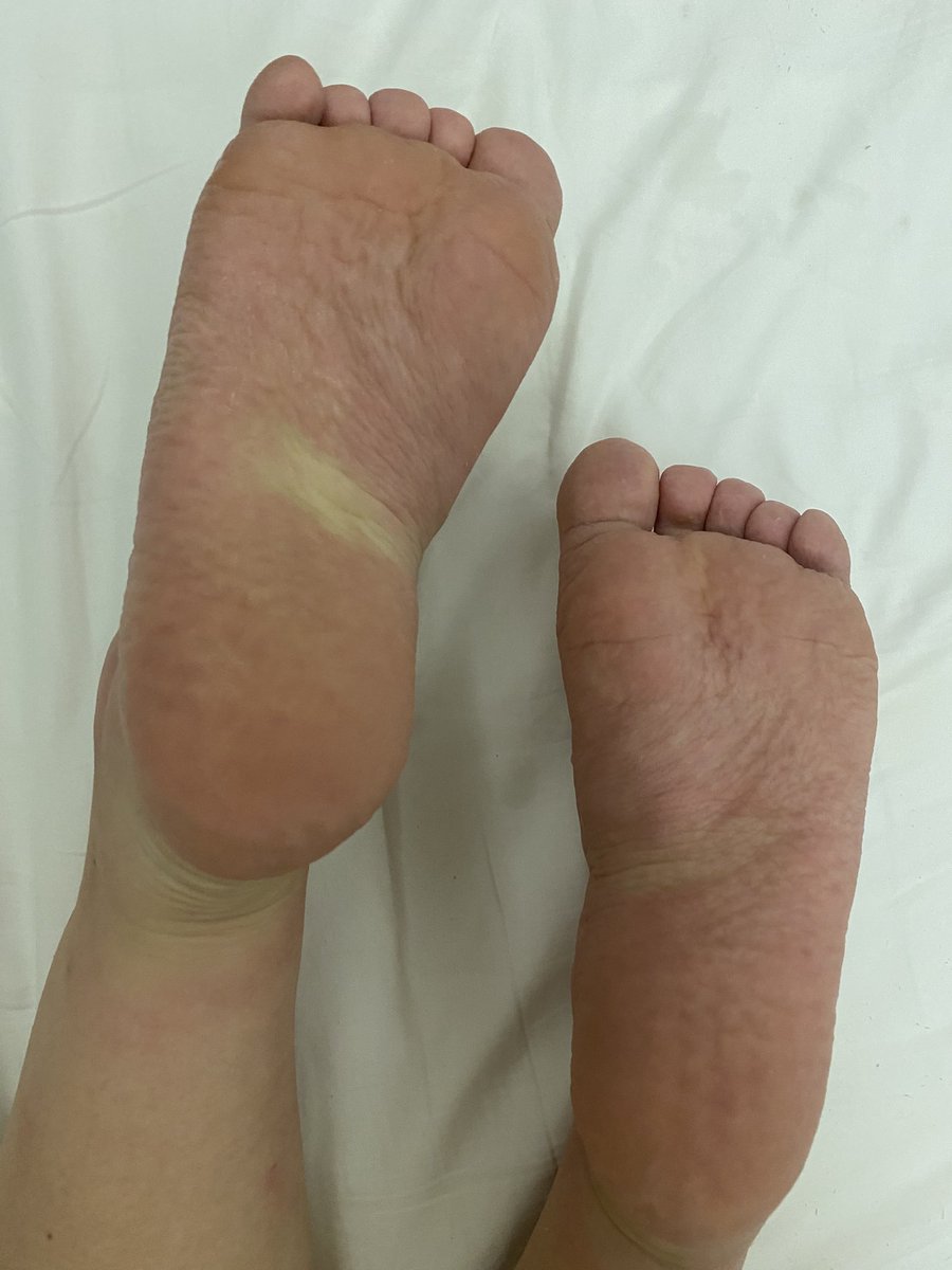 喜欢裸足还是白丝？点赞评论➕关注➕转推（扣1抽一人免费送白丝、扣2抽一人免费玩）