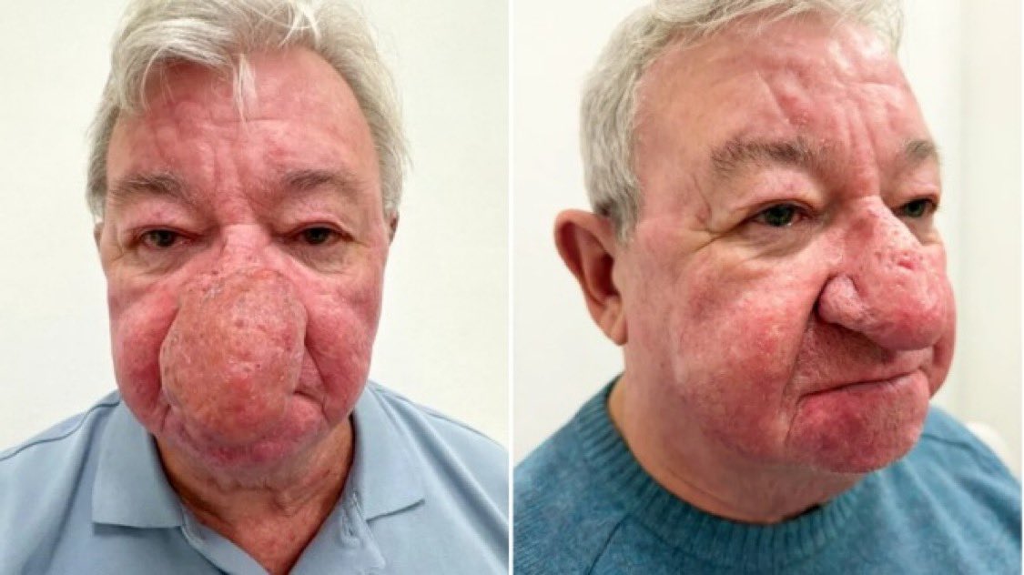 世界のど迫力映像@フォレスト(Forest)🕊️ tweet media