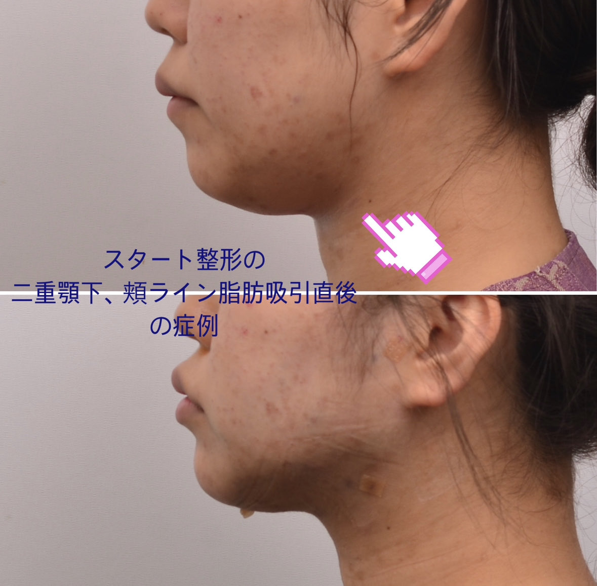 スタート整形外科&ヨンセUP整形病院の案内 tweet media