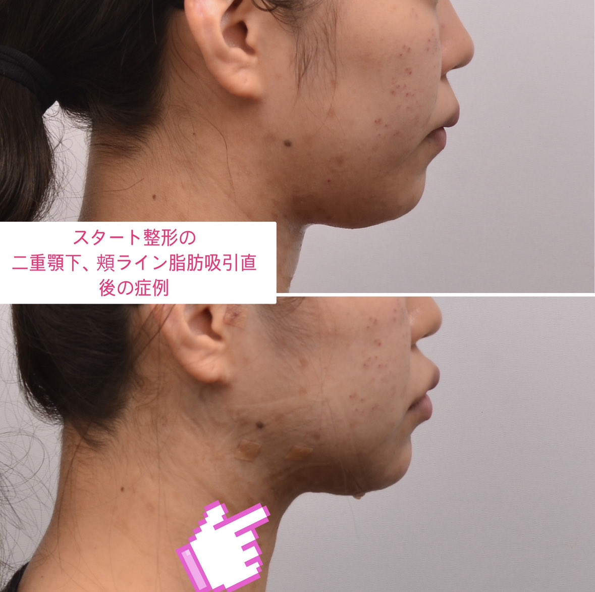 スタート整形外科&ヨンセUP整形病院の案内 tweet media