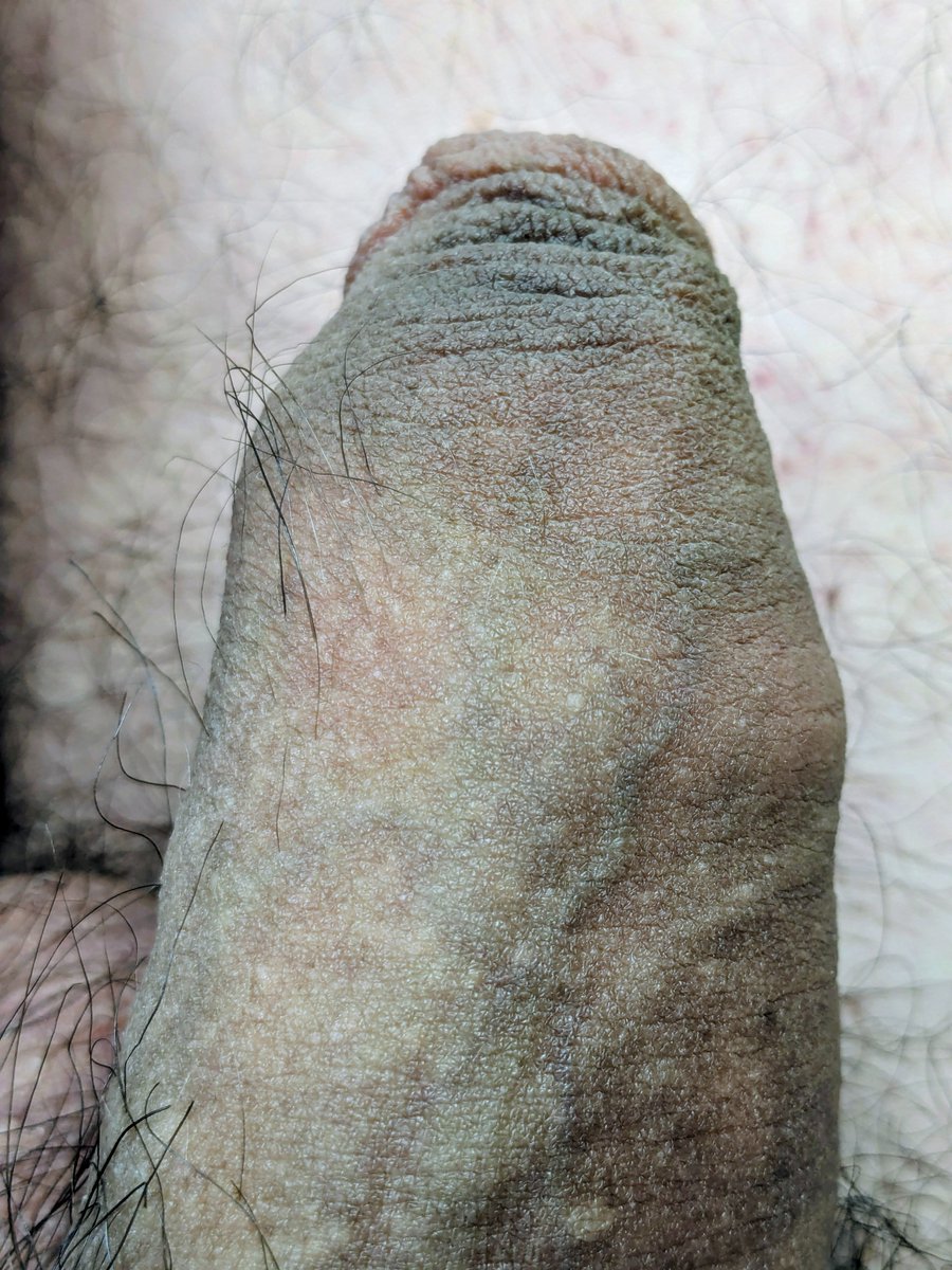 <a href="/ALTGeordielad/">ALTGeordielad (28k)</a> Uncut and hairy