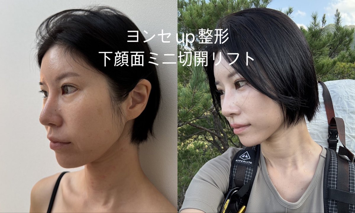 スタート整形外科&ヨンセUP整形病院の案内 tweet media