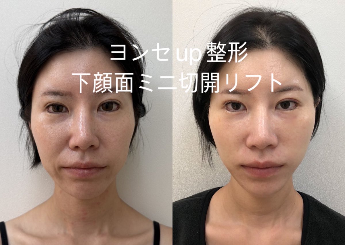 スタート整形外科&ヨンセUP整形病院の案内 tweet media