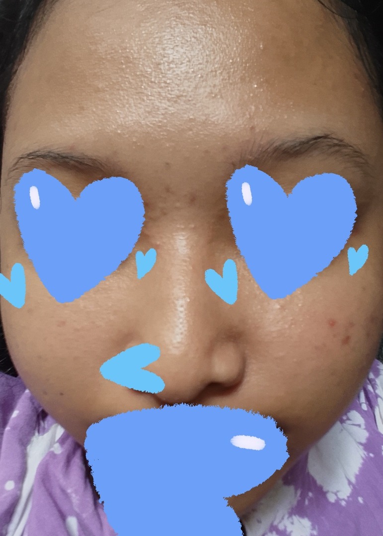 🚫 NO LINK! BACA RULES tweet media