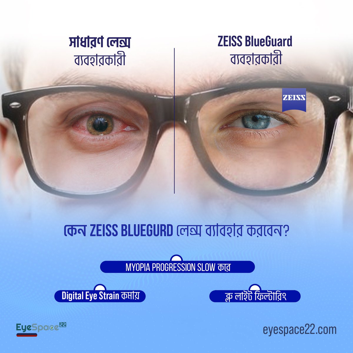 eyespace22's tweet image. Staring at screens all day but tired of that heavy, burning sensation in your eyes? 🖥️🔥
Digital eye strain is real, and standard glasses often aren't enough to block high-energy blue light. It’s time to switch to a smarter solution. 🧵👇
eyespace22.com/zeiss/
#EyeHealth #ZEISS