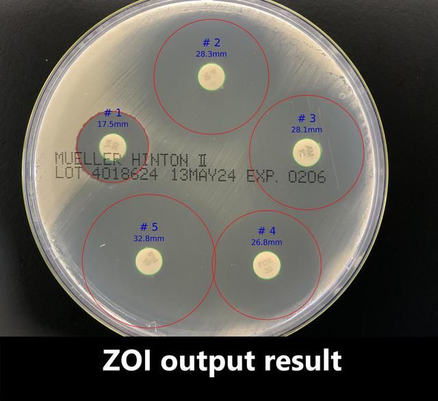 CarbConnect's tweet image. Part of the CarbConnect® Applications catalog — a growing library of AI apps for biomedical research workflows.

Try ZOI 1.0 👉 dev.carb-connect.com/applications/Z…

#AMR #ClinicalMicrobiology #LifeSciences