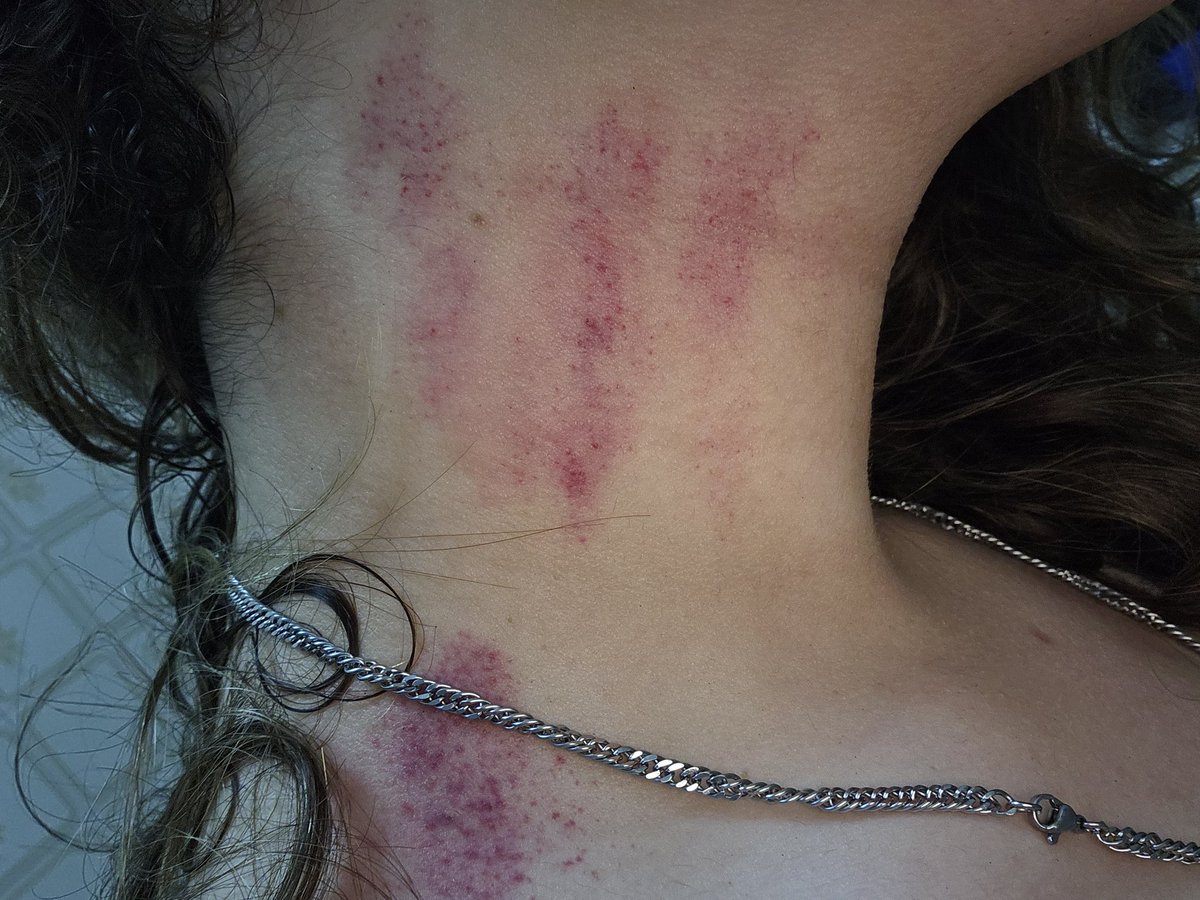 🔞 Leinth Aritimis 🔞 tweet media