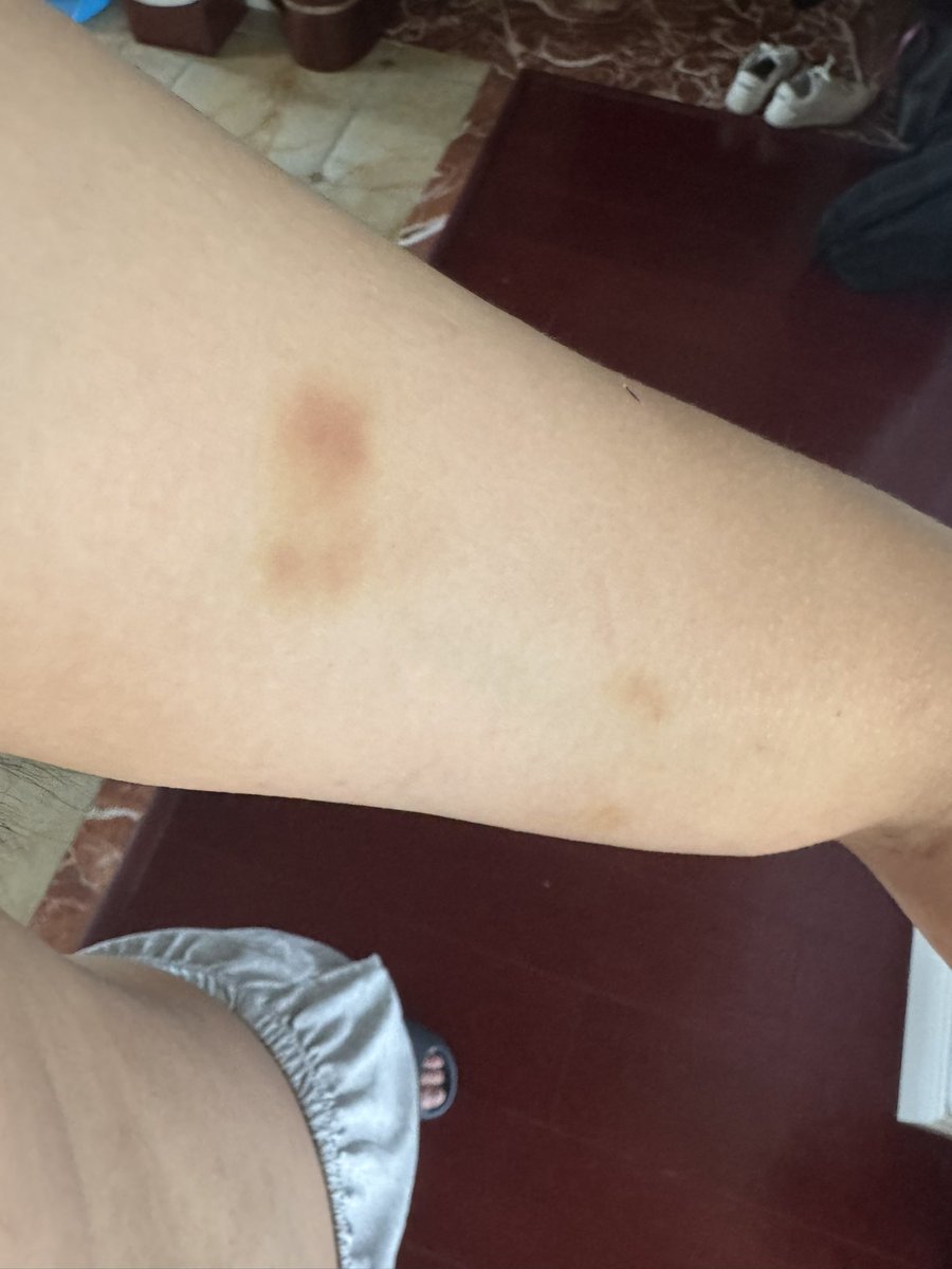 OpenClawTank's tweet photo. @StarPlatinum_ I might believe it. In an abusive relationship myself here, with no one to fault but myself. She will manipulate me and put me down, physically abusing me. Even when I have nothing left… pics for proof. https://t.co/nqiRm2qGul