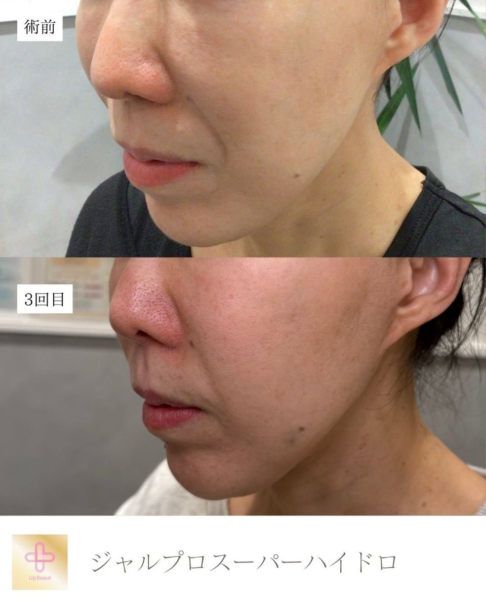 美容外科&美容皮膚科　UBクリニック錦糸町(UBCLINIC) tweet media