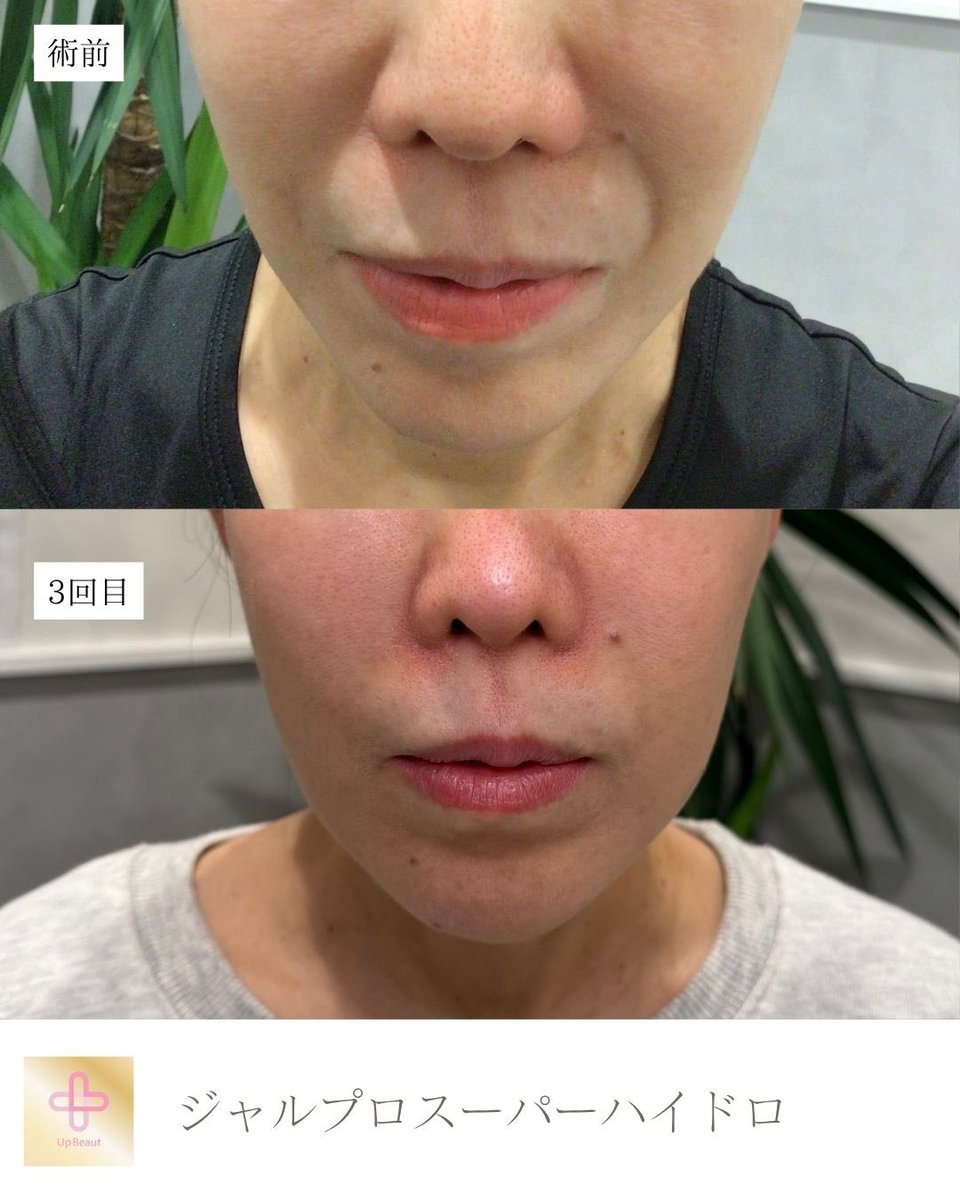 美容外科&美容皮膚科　UBクリニック錦糸町(UBCLINIC) tweet media