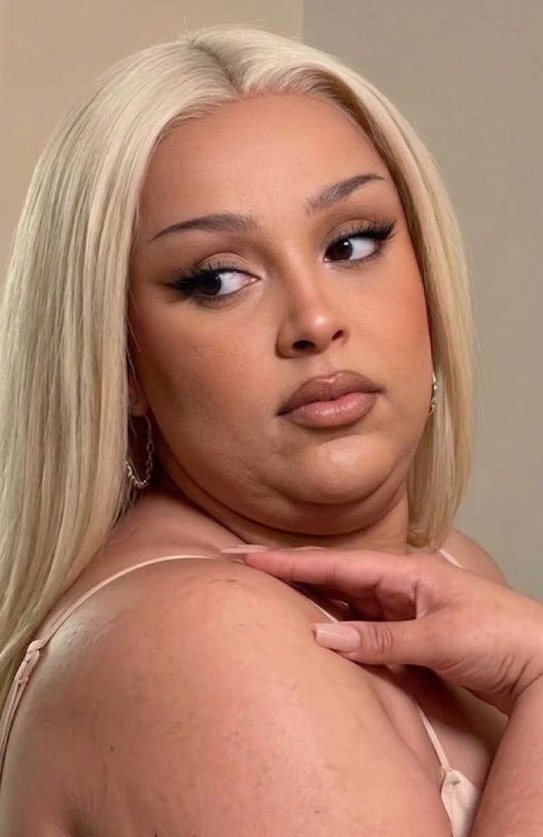 zorio🌹 tweet media