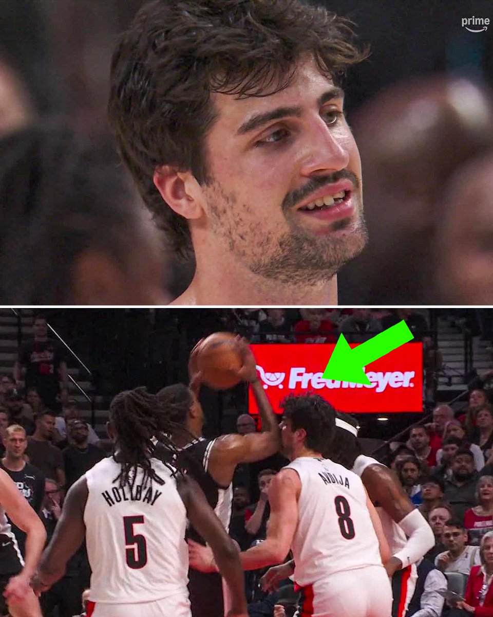 Blazers' Deni Avdija's tooth damaged by elbow strike