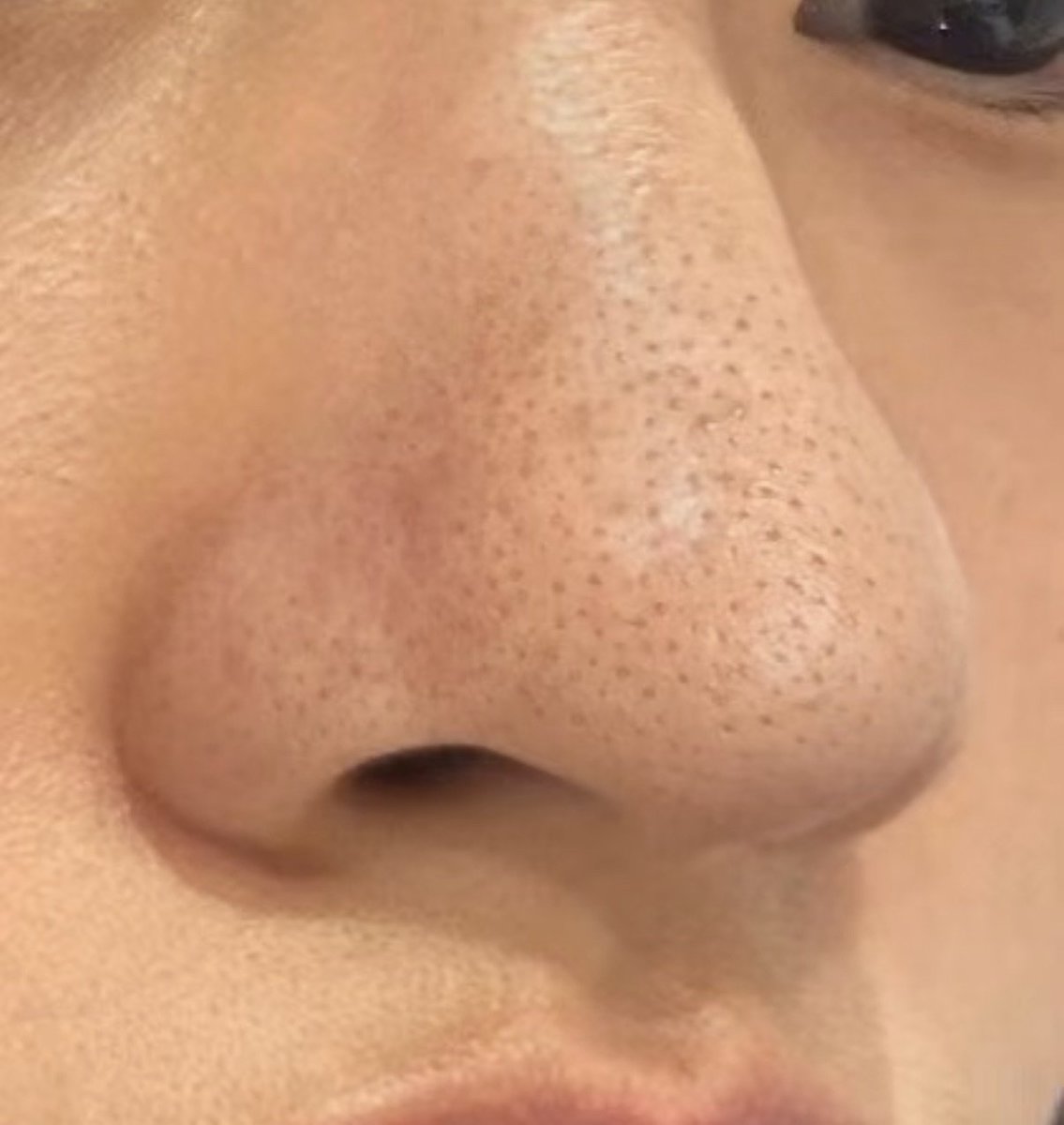 moru 🐇 tweet media