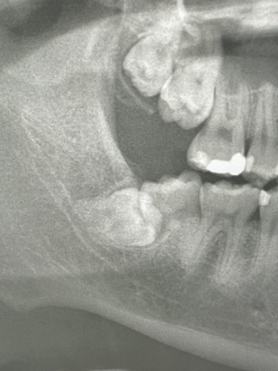 一生許さないからな
特に下のやつ