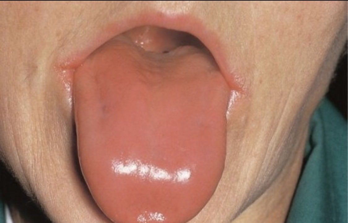 Toda Hora The Office tweet media