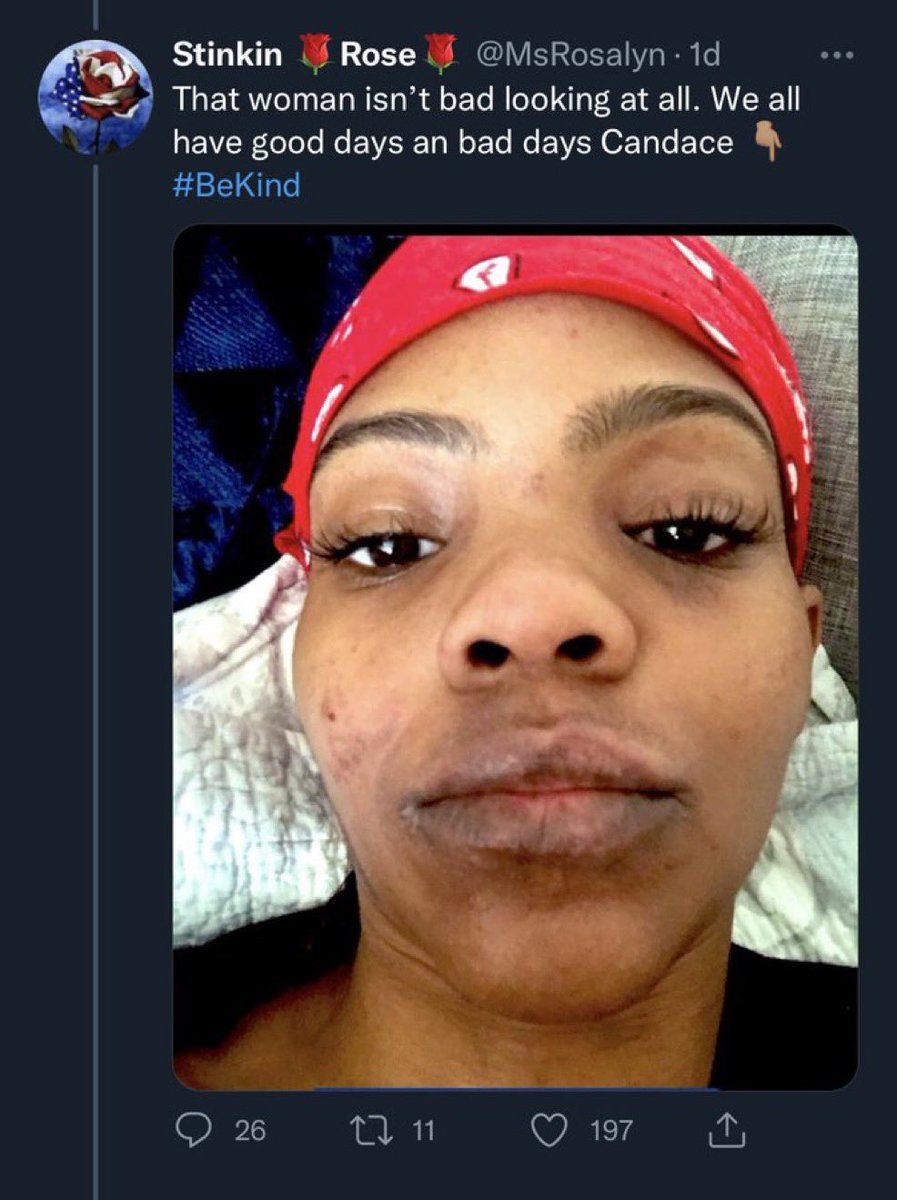 Don Salmon tweet media