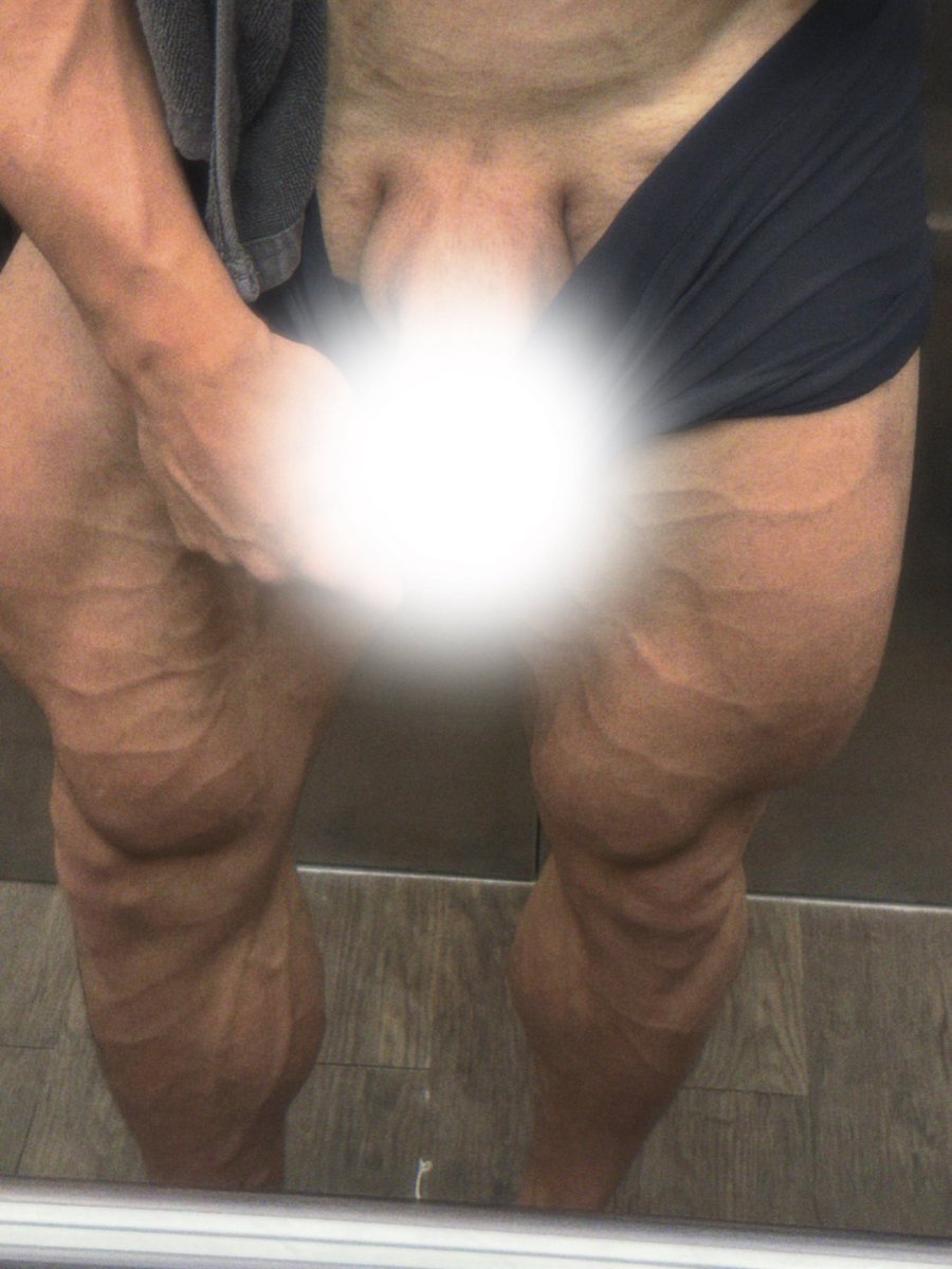 znldz3xl