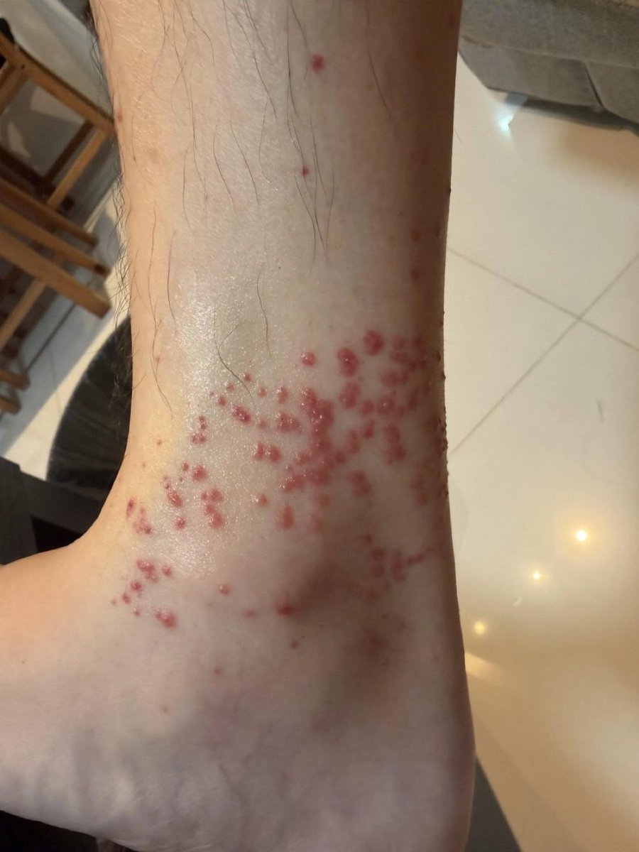 All_round£r🥼💙 tweet media