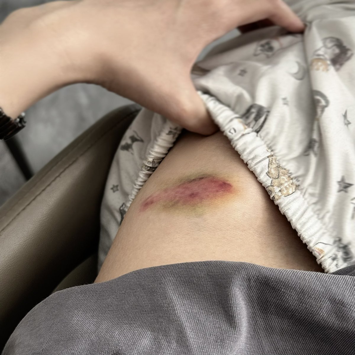 阿不不 tweet media