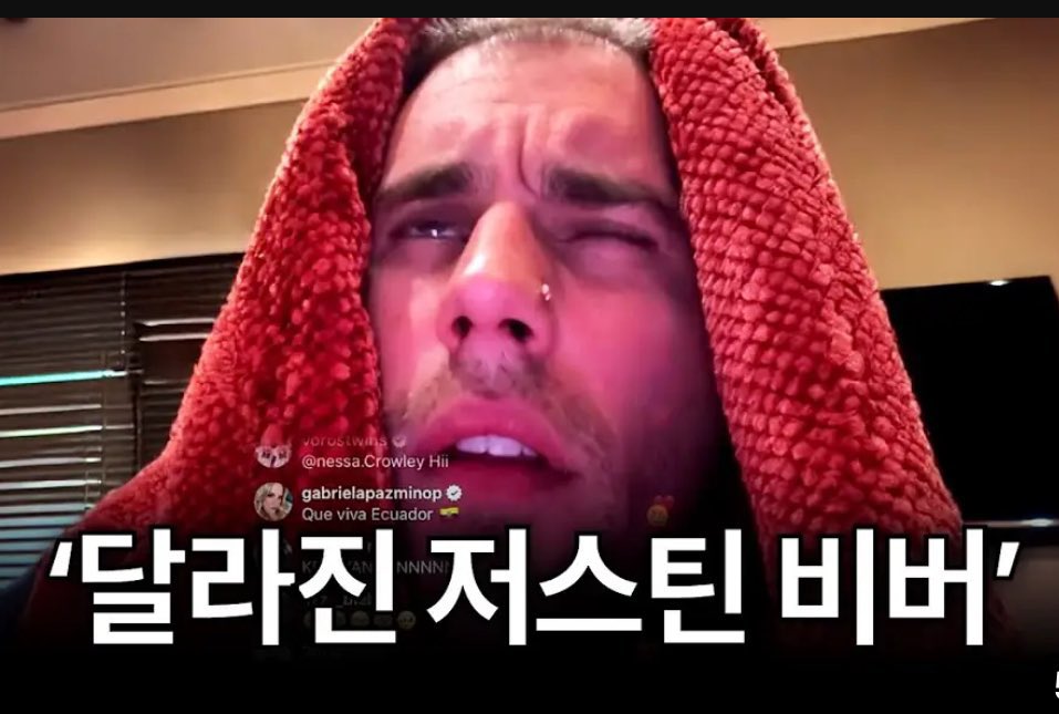 비가역적 치수염 걸린 저스틴비버 tweet media