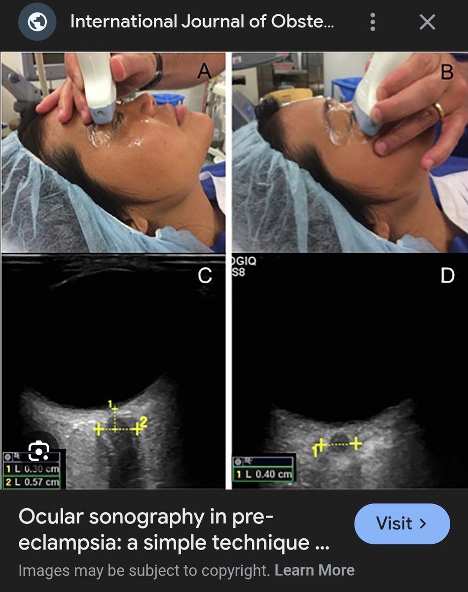 GwenP00Le tweet media