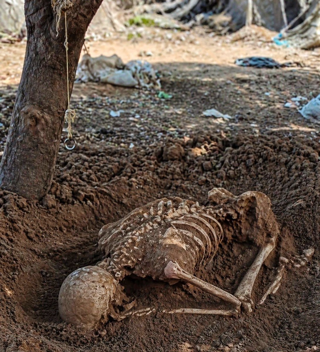 Bugün,Kuzey Gazze’de yaralandıktan sonra üç gün boyunca kan kaybeden bir şehidin naaşına ulaşıldı.Secde hâlinde bulunan mübarek bedeni, Rabbine teslimiyetin en derin nişanesi gibiydi. 👇👇👇👇