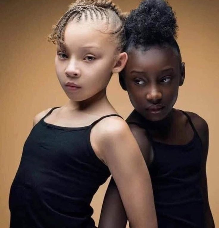 fwskiiii's tweet photo. Black girl you're beautiful no matter your shade. https://t.co/a1LRHoHSyB