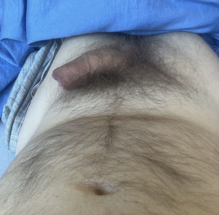 Chifoumi 🇨🇭 tweet media