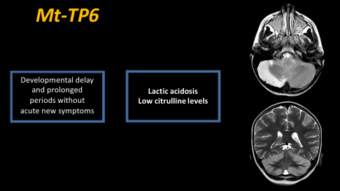 The_ASPNR's tweet photo. Dr. Cesar Alves (@cesaralvesneuro) shows cerebellitis-like presentation and basal ganglia lesion in the mitochondrial disorder ATP6. Increased blood lactate and decreased citrulline suggestive. If white matter change + cerebelitis-like, think about NUBPL.  #pedineurorad #pedsrad https://t.co/zQgZMlWlXD