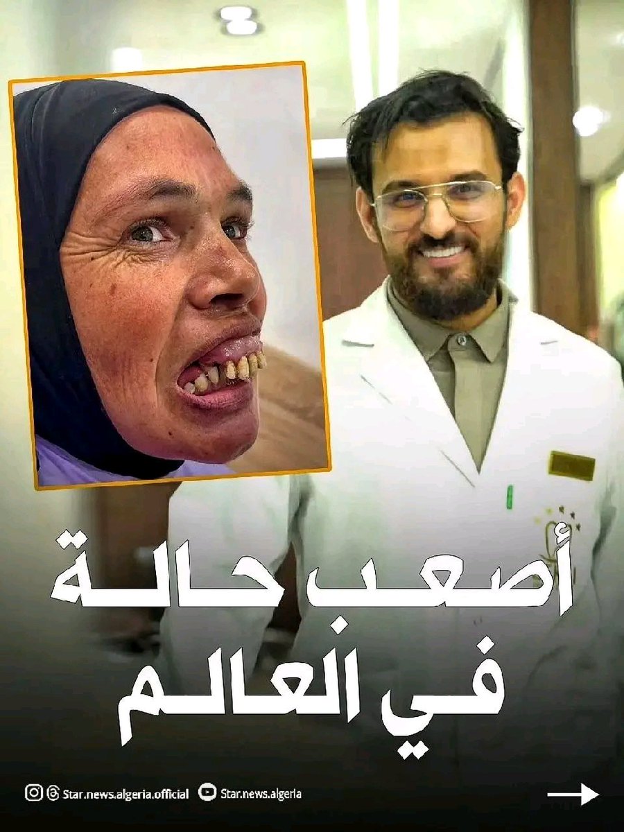 Brahimteacher's tweet photo. هذه العملية المعجزة في تقويم الأسنان في #الجزائر .
ومع ذلك هناك من مازال يشكك في مستوى الطب في بلادنا .. 
 الطبيب زكري ربي يبارك فيه وفي طاقمه
ومبارك لهاذ الأخت فرحتلها.. https://t.co/mdPwfTSED6
