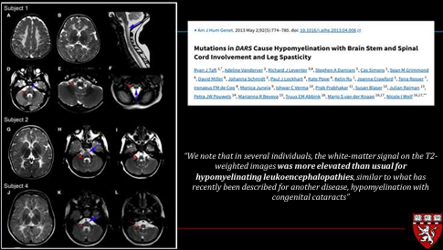 The_ASPNR's tweet photo. Dr. Cesar Alves (@cesaralvesneuro) shows illustrative examples of DARS mutation related HBSL and LBSL. Sparing of intraxial segmental trigeminal nerve common with DARS1 but rare in DARS2. #PediNeuroRad #radres #pedsrad https://t.co/nlm9N9vt79