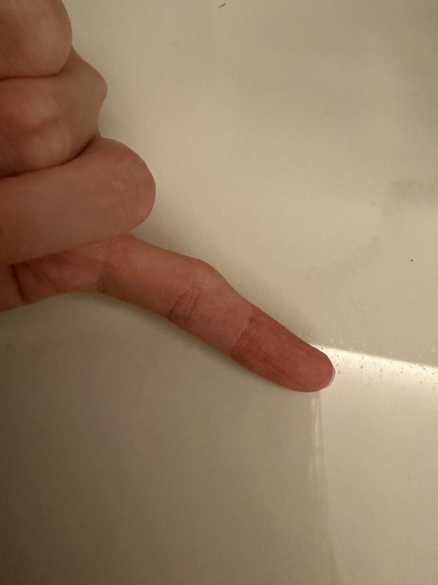 momo_tsujino's tweet image. 私の曲がってしまった小指の訳動画！！
思春期の頃は気にして隠すためにジャンケンぐー👊かチョキ✌️しか出さなかったよ🥹笑笑笑

太郎の投稿動画を楽しみましょう！#TikTok vt.tiktok.com/ZS96k2nkY/