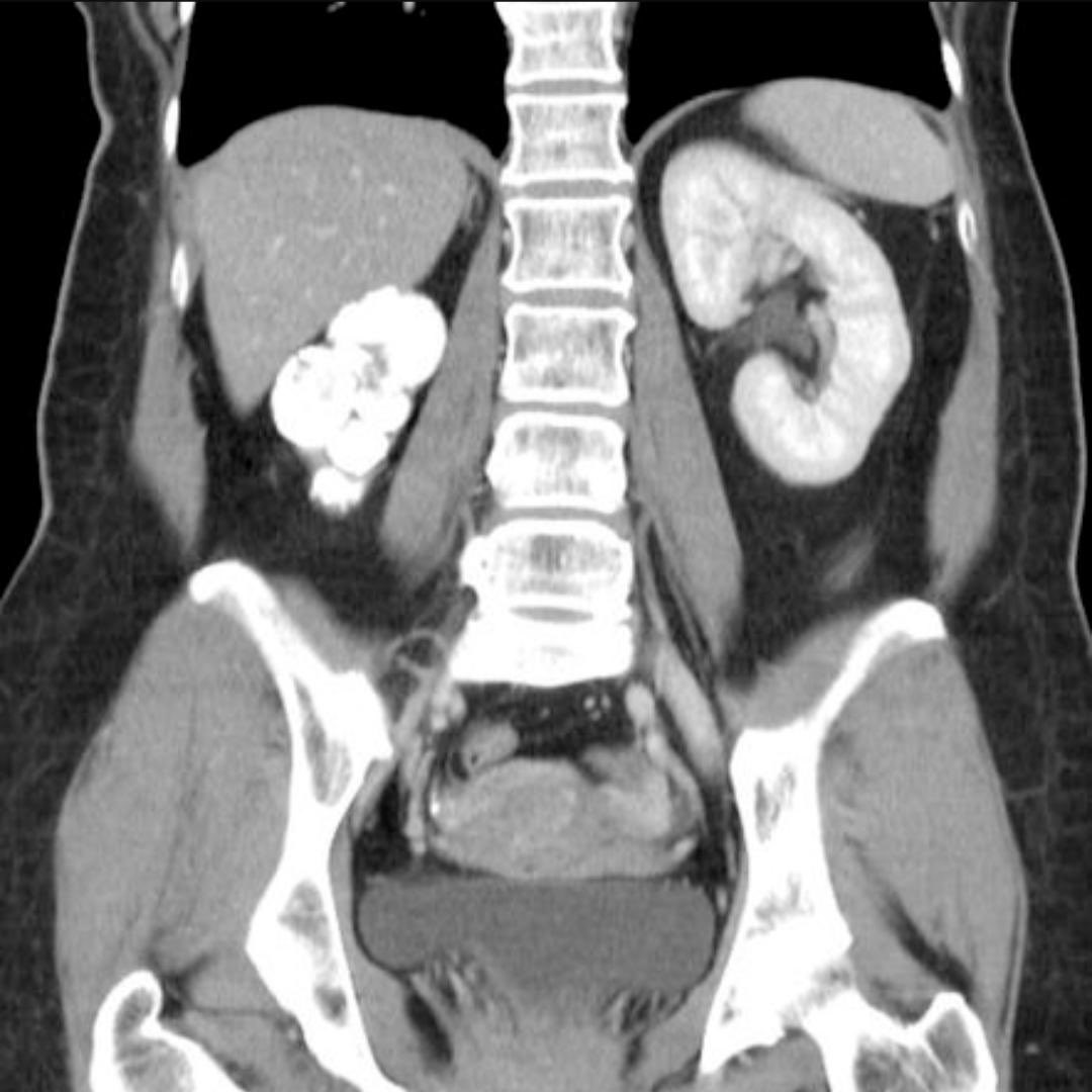 Dr.Rahul Poptani tweet media