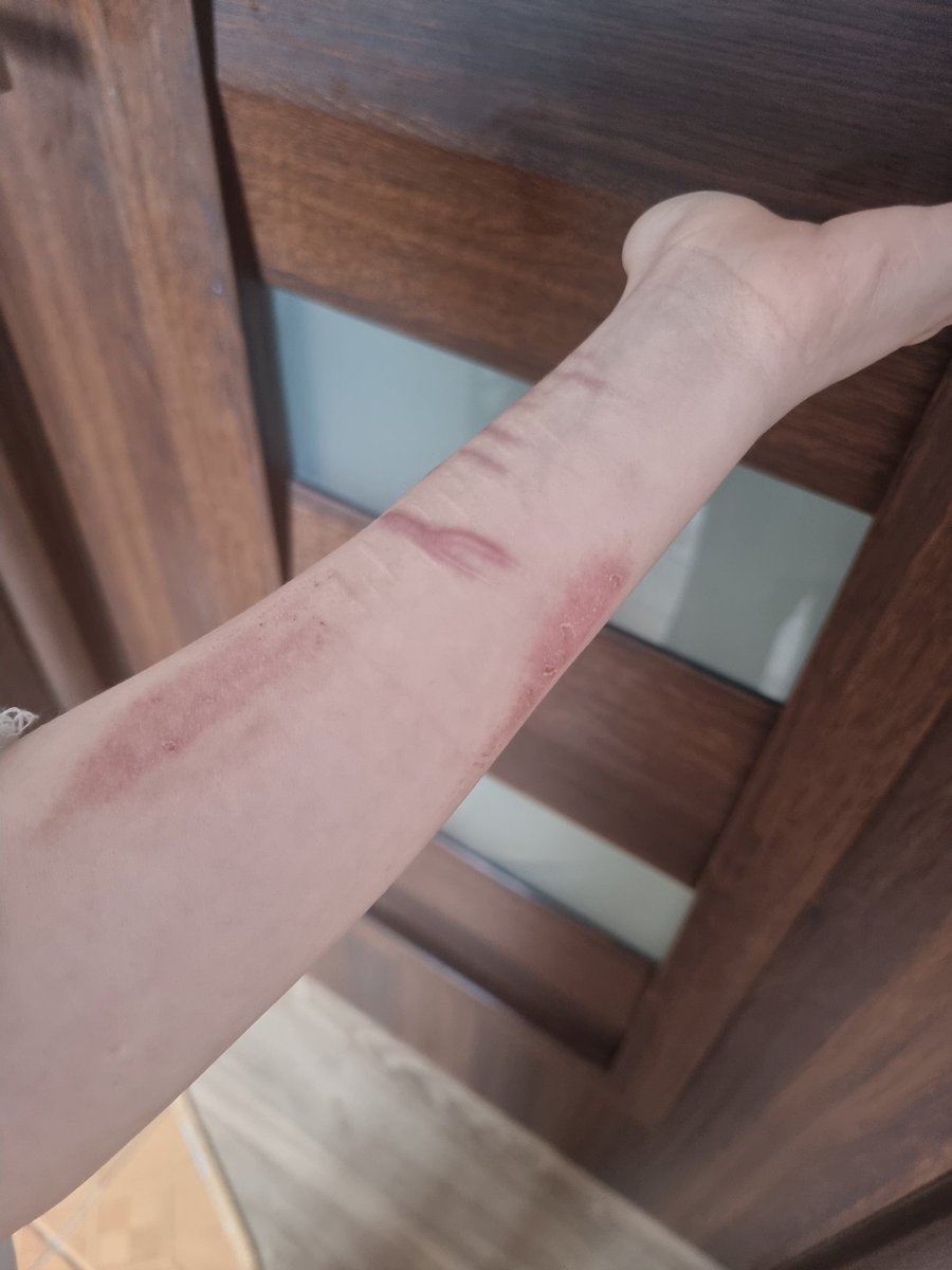 𝓷𝓪𝓸𝓶𝓲໒꒰ྀི´ ˘ ` ꒱ྀིა shedtwt tweet media