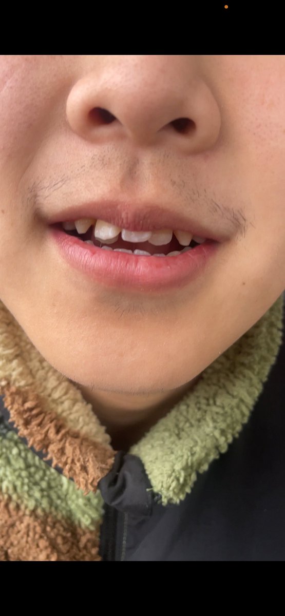 ハイビスカス東京🔰🌺 tweet media