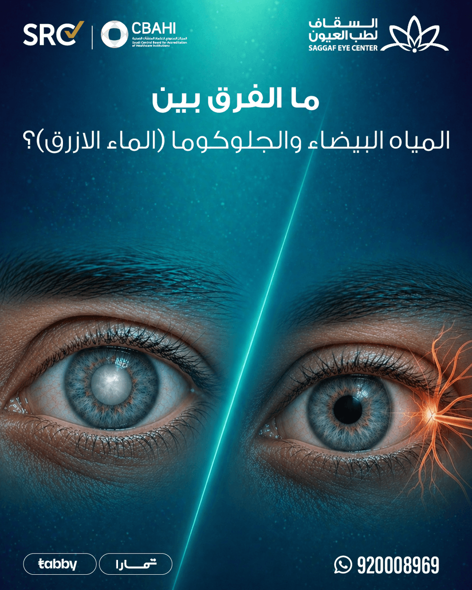 السقاف لطب وجراحة العيون Saggaf Eye Centre tweet media
