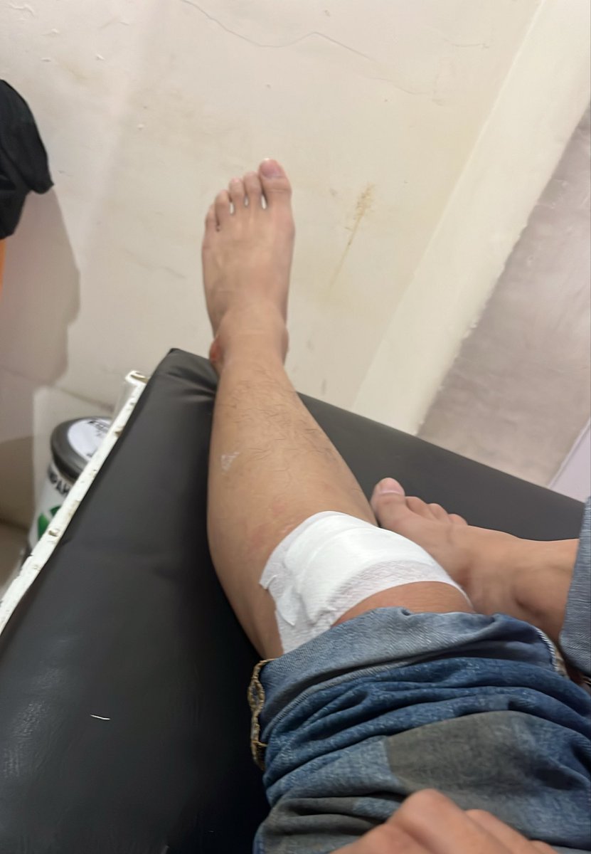 nokigaling's tweet photo. another proof of my stupidity, i happened to fall out of  my motor in the day of my birthday lol https://t.co/qhJGAjifiz