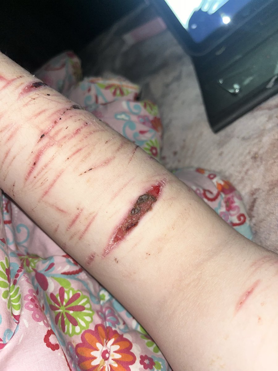 ☠︎gerard way of shedtwt☠︎ tweet media