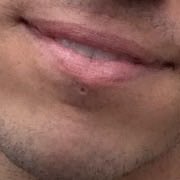 alex |-/ tweet media