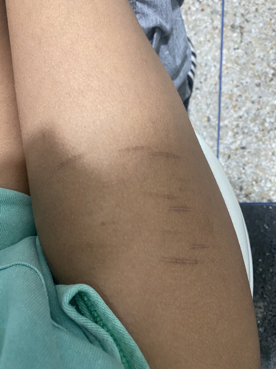 bkdk of shedtwt ‧˚꒰🐾୭ ˚. ᵎᵎ tweet media