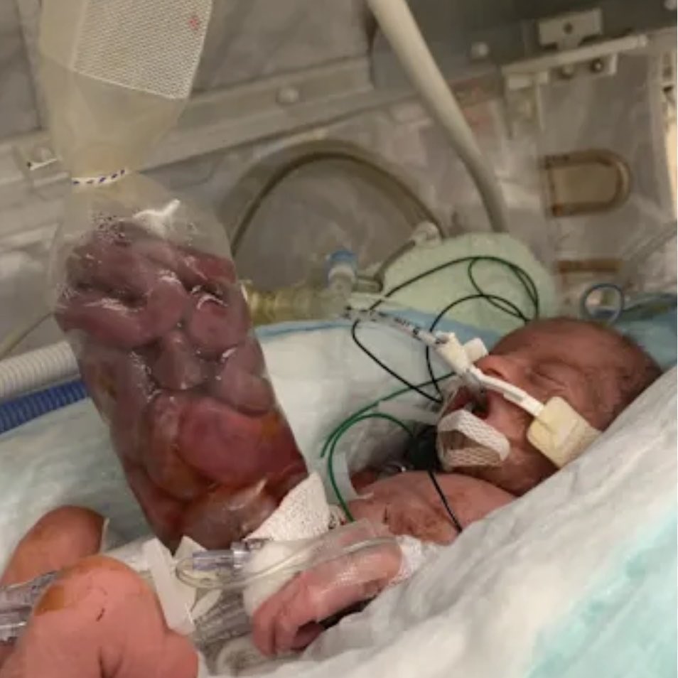 Sigurd 🐸 tweet media