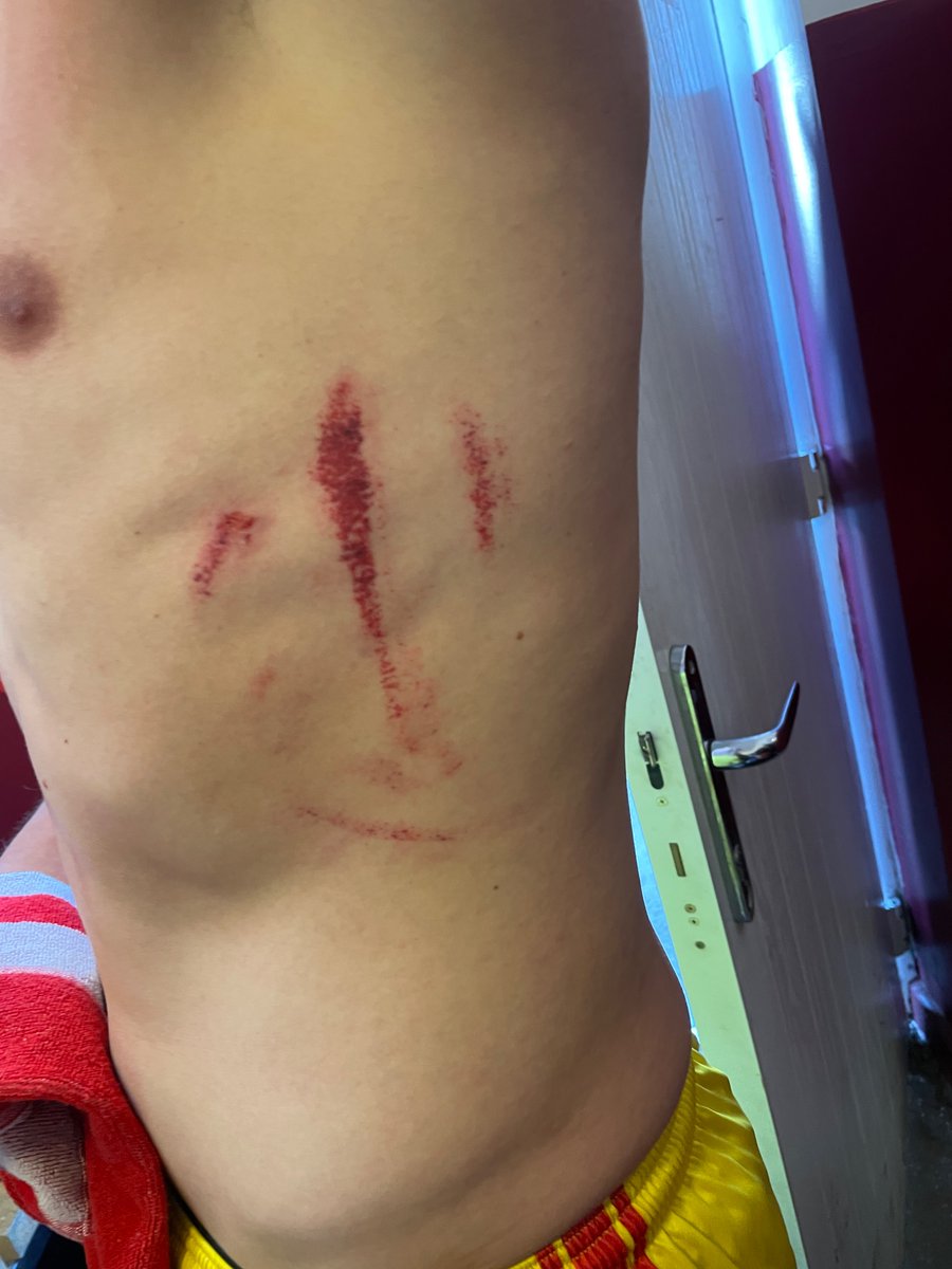 Nathan Fennell Sports Therapist tweet media