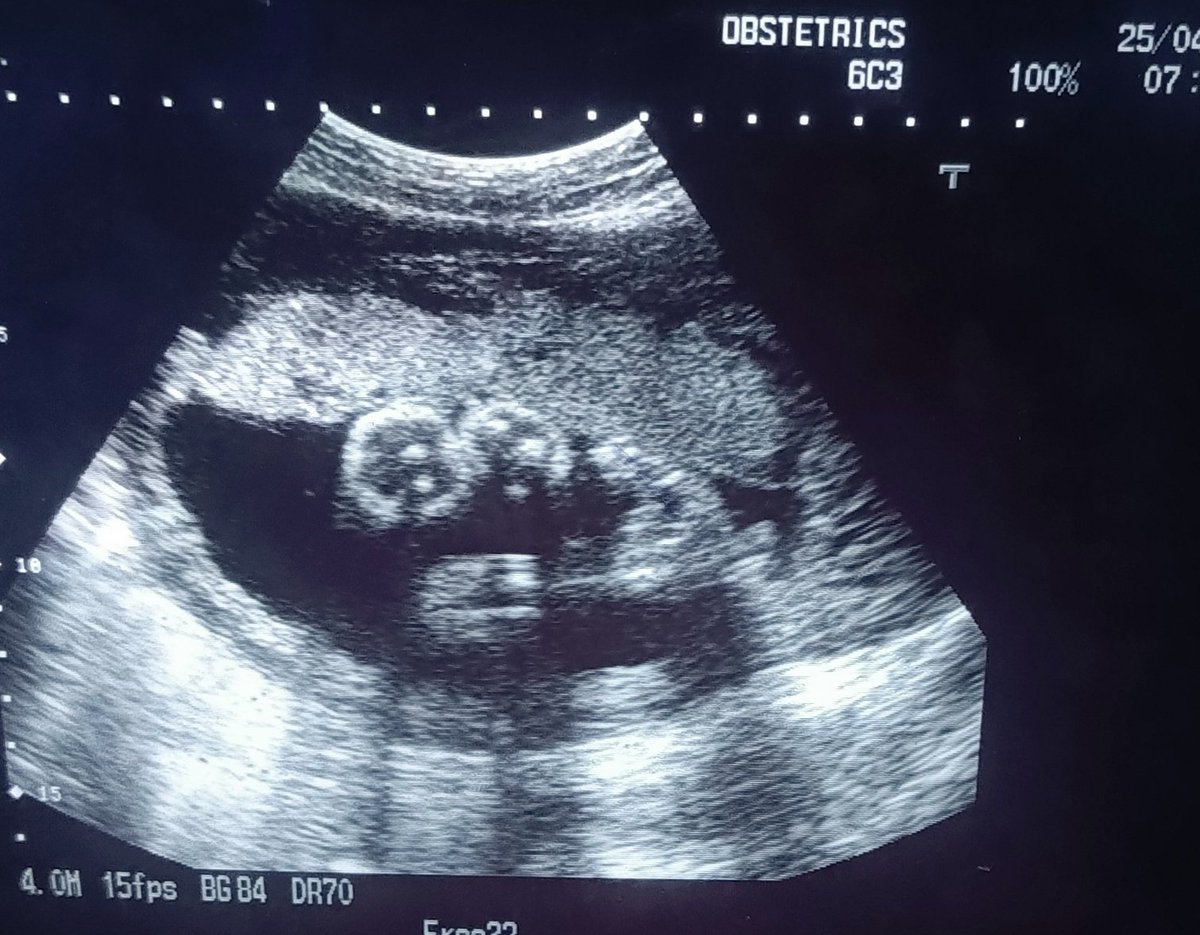 ChroRadGirlie tweet media