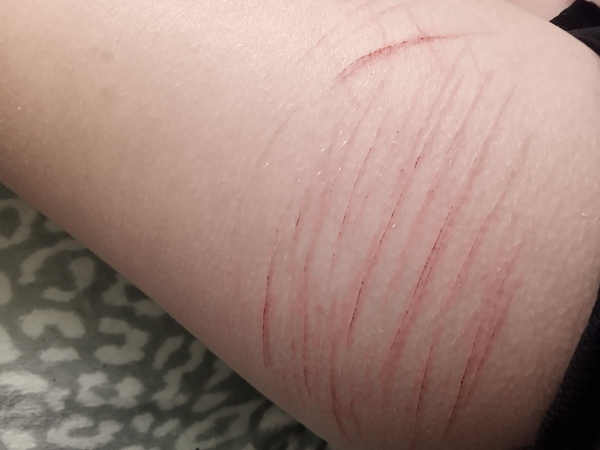 Tabbyscars's tweet photo. #shedtwt #shtwt thigh sesh https://t.co/sYAIxvpYz7
