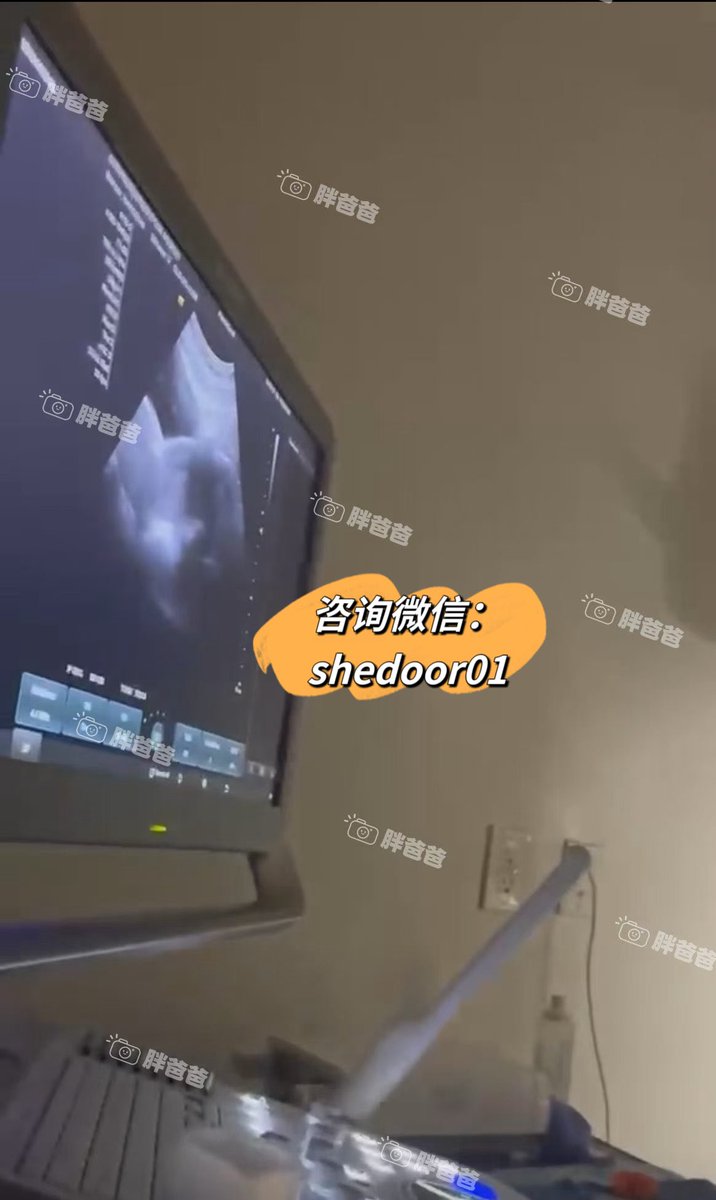 VeraKps's tweet photo. 又一位爱心妈妈顺利完成移植啦✅
从匹配成功到移植，每一步都经过医生严格把关和审核，合格了才能进入最终阶段。
感谢麻麻的积极配合，也谢谢准父母的耐心等待
海外代孕 单身未婚试管婴儿 白人模特实名精子库卵子库 高龄大龄卵巢早衰 胎停流产试管 https://t.co/Dl37ZtPnHG